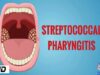 STREPTOCOCCAL PHARYNGITIS, Causes, Signs and Symptoms, Diagnosis and Treatment.