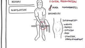 Septic Arthritis – Overview (causes, pathophysiology, treatment)