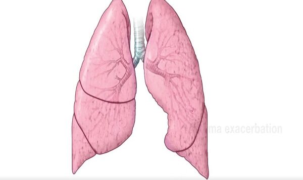 Signs of asthma