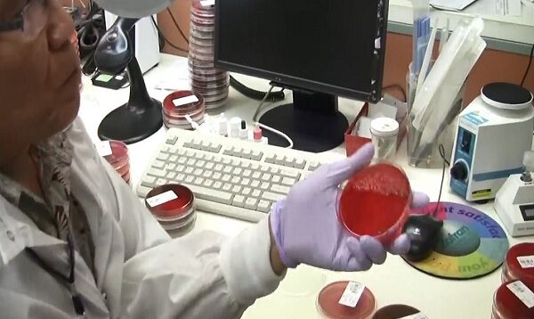 Sputum Culture