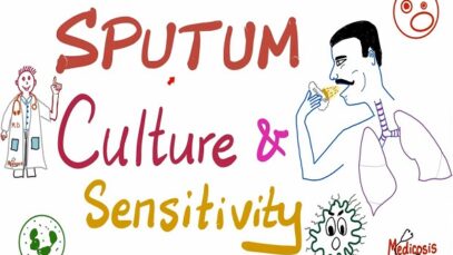 Sputum Culture and Sensitivity – Sputum Sample – Labs