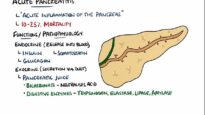 Acute Pancreatitis – Causes, Signs Symptoms, Pathophysiology, Diagnosis