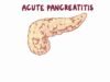 Acute pancreatitis