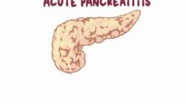 Acute pancreatitis