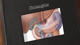 Cholangitis