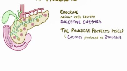 Chronic pancreatitis – causes, symptoms, diagnosis, treatment, pathology