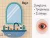 Conjunctivitis (Pink Eye)