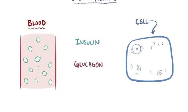 Diabetes mellitus (type 1, type 2) diabetic ketoacidosis (DKA)