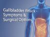 Gallstones – Gallbladder Attack Symptoms Treatment