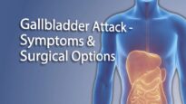 Gallstones – Gallbladder Attack Symptoms Treatment
