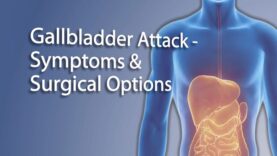 Gallstones – Gallbladder Attack Symptoms Treatment
