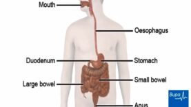 How a peptic ulcer develops