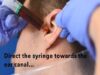 How to Perform an Ear Washout – ENT-Otolaryngology Skills