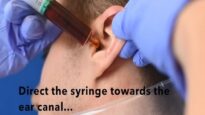 How to Perform an Ear Washout – ENT-Otolaryngology Skills
