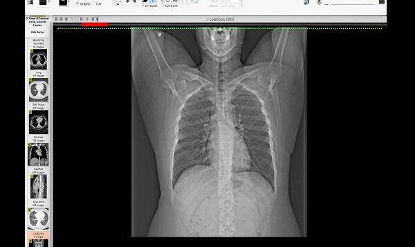 How I Read a Chest CT