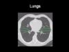How to identify normal lung anatomy on chest CT1