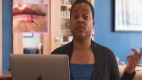 Is There A Cure for Herpes