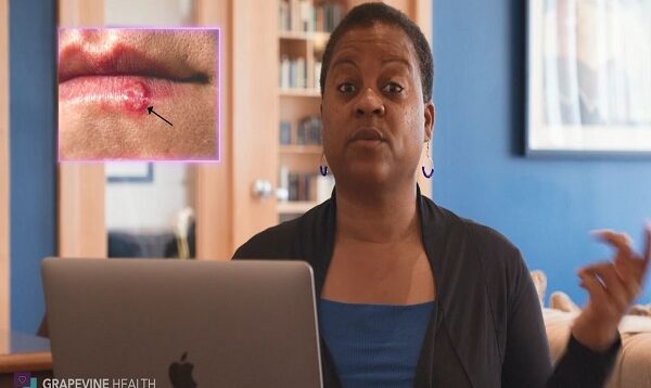 Is There A Cure for Herpes