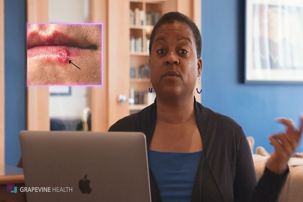 Is There A Cure for Herpes