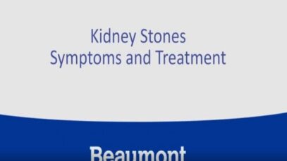 Kidney Stones Symptoms and Treatments