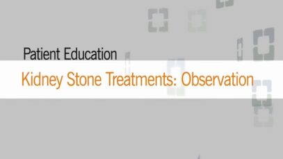 Non-surgical Approach to Kidney Stones