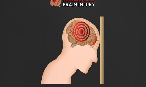 Overview of Traumatic Brain Injury