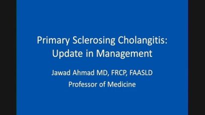 Primary Sclerosing Cholangitis