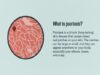 Psoriasis- Signs, Symptoms, Causes, and Treatment
