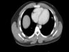 Radiology_ How to Read a CT Abdomen _ Pelvis