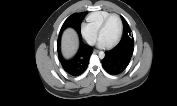 Radiology_ How to Read a CT Abdomen _ Pelvis
