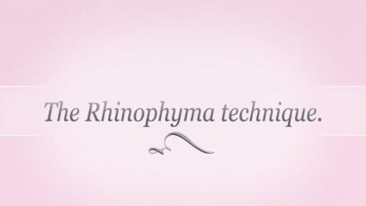 Rhinophyma