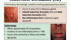 Seborrheic Dermatitis (Dandruff and Cradle Cap) Causes, Risk Factors, Symptoms, Diagnosis, Treatment