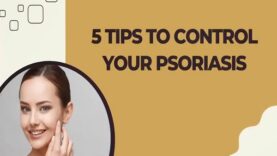 TOP 5 TIPS TO CONTROL PSORIASIS FLARES DERMATOLOGIST