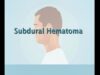 Understanding Subdural Hematoma