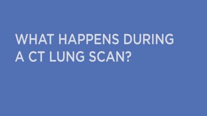What Happens During a CT Lung Scan