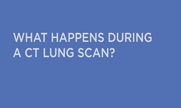 What Happens During a CT Lung Scan