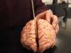 Anatomy of the Brain – Dissectible Model