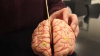 Anatomy of the Brain – Dissectible Model