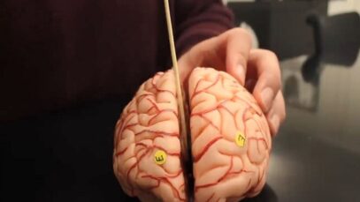 Anatomy of the Brain – Dissectible Model