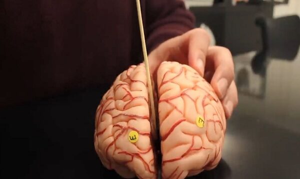 Anatomy of the Brain – Dissectible Model