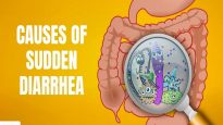 Causes of Sudden Diarrhea