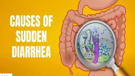 Causes of Sudden Diarrhea