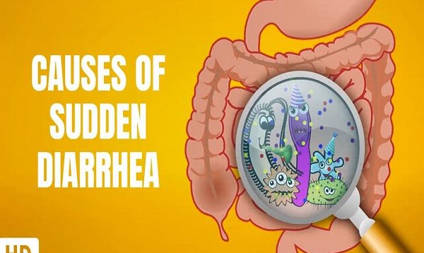 Causes of Sudden Diarrhea