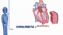 Endocarditis- Clinical Nursing Care