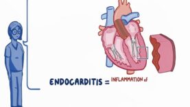 Endocarditis- Clinical Nursing Care