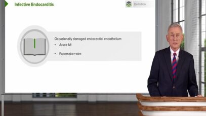 Endocarditis- Definition, Pathology, Classification Diagnosis – Infectious Diseases