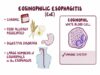 Eosinophilic esophagitis