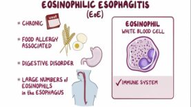 Eosinophilic esophagitis