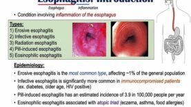 Esophagitis (Esophagus Inflammation)- Causes, Risk Factors, Signs and Symptoms, Diagnosis, Treatment