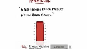 Hypertension Explained (High Blood Pressure) – Includes Hypertensive Emergency NICE Guidelines